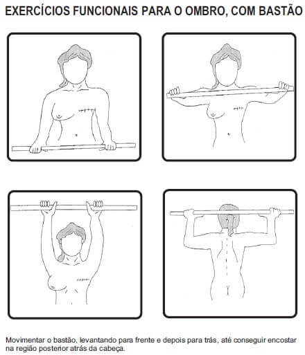 Exercícios funcionais para o ombro em fisioterapia para mulheres mastectomizadas