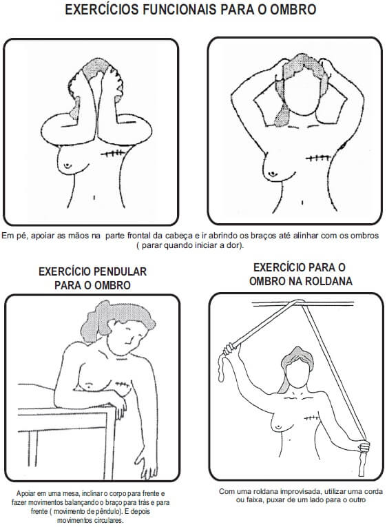 Exercícios funcionais para o ombro em fisioterapia para mulheres mastectomizadas